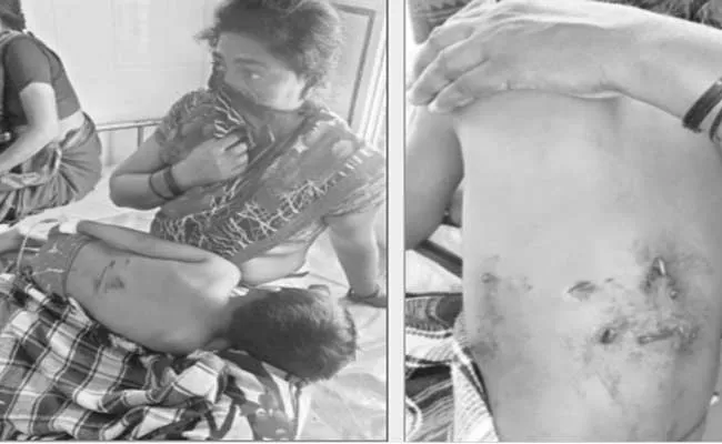 Dogs Attacked On Five Year Old Boy - Sakshi