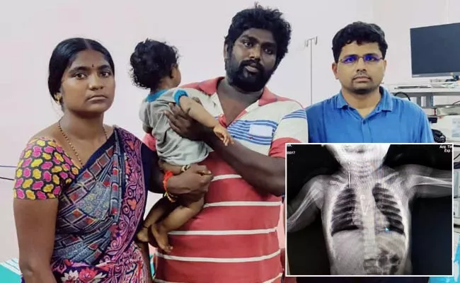 Little Girl Swallowed Pinnies In Kurnool District - Sakshi
